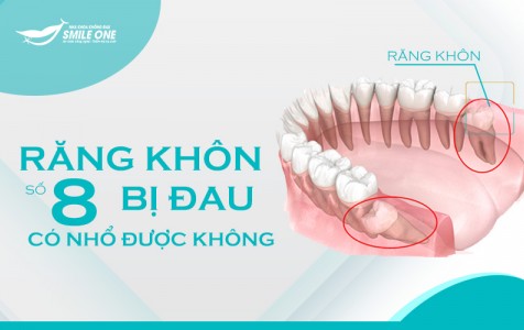 Răng khôn bị đau phải làm sao, có nhổ được không?